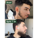 Huile à Barbe Naturelle - Pousse et Hydratation