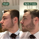 Huile à Barbe Naturelle - Pousse et Hydratation