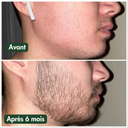 Huile à Barbe Naturelle - Pousse et Hydratation