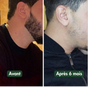 Huile à Barbe Naturelle - Pousse et Hydratation