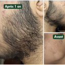 Huile à Barbe Naturelle - Pousse et Hydratation