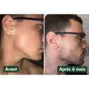 Huile à Barbe Naturelle - Pousse et Hydratation