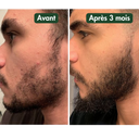 Huile à Barbe Naturelle - Pousse et Hydratation