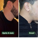 Huile à Barbe Naturelle - Pousse et Hydratation